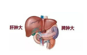 脾大的原因,探究病因与治疗策略